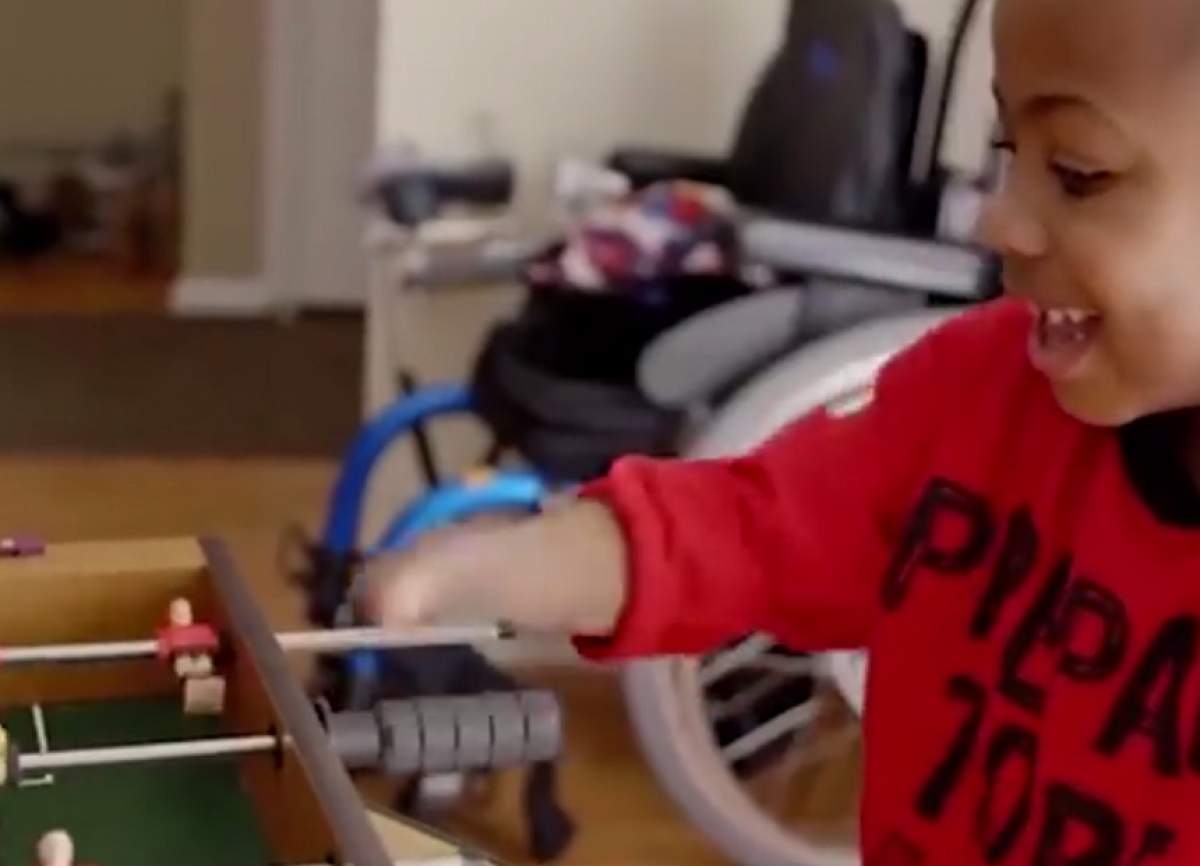 VIDEO / I-au fost amputate mâinile când era mic! A primit altele prin transplant, dar corpul le-a respins! Cum arată după 2 ani
