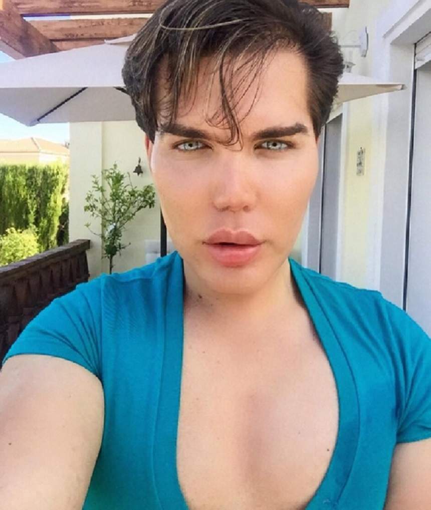 VIDEO / Veste ŞOC! Rodrigo Alves, supranumit păpuşă umană Ken, ar putea rămâne fără nas