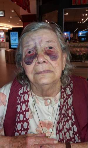 FOTO / Imaginile durerii! O bătrânică a fost bătută cu bestialitate de ginerele ei