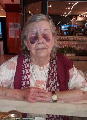 FOTO / Imaginile durerii! O bătrânică a fost bătută cu bestialitate de ginerele ei