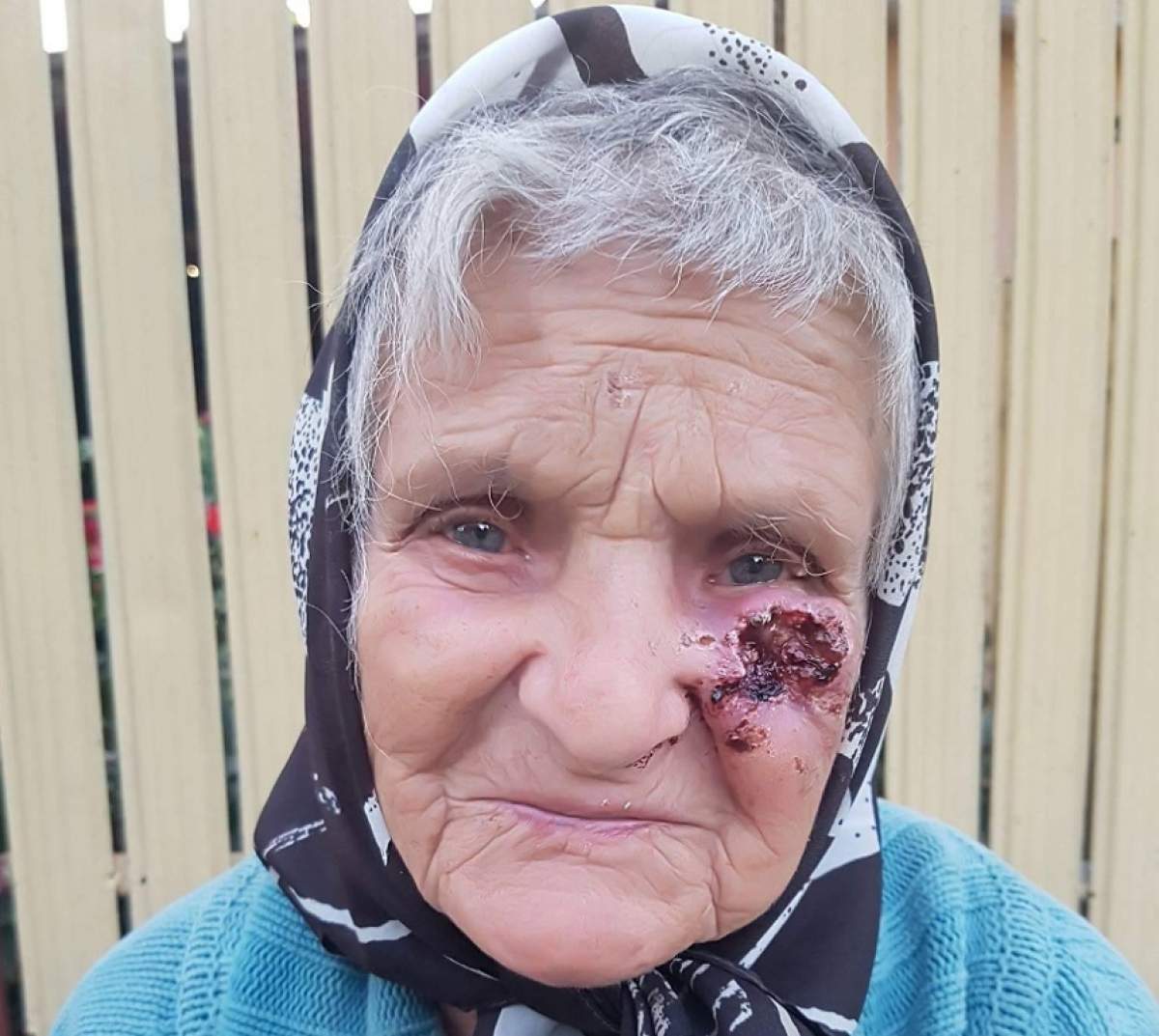 FOTO / Bătrânică bătută cu bestialitate de fiul ei! Vecinii sunt şocaţi: "Face viermi la rana de pe obraz"