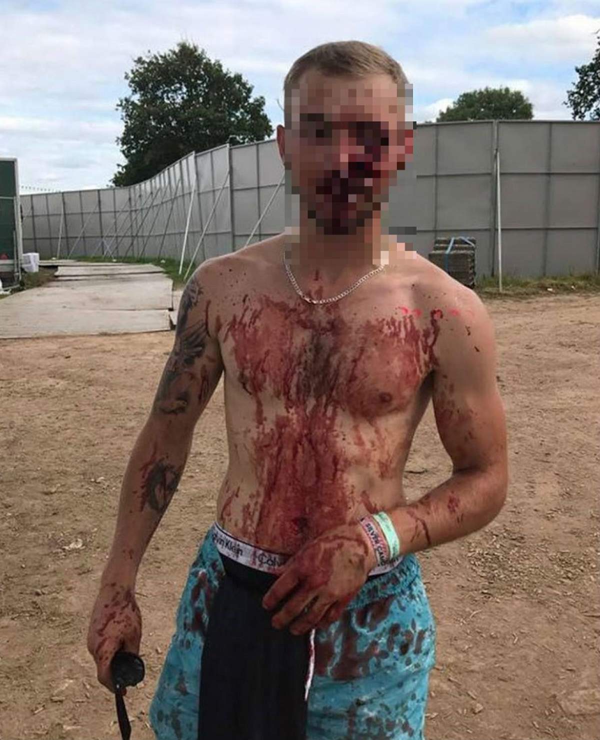 FOTO / Şocant! Un băiat a rămas mutilat pe viaţă, după ce a fost înjunghiat în faţă