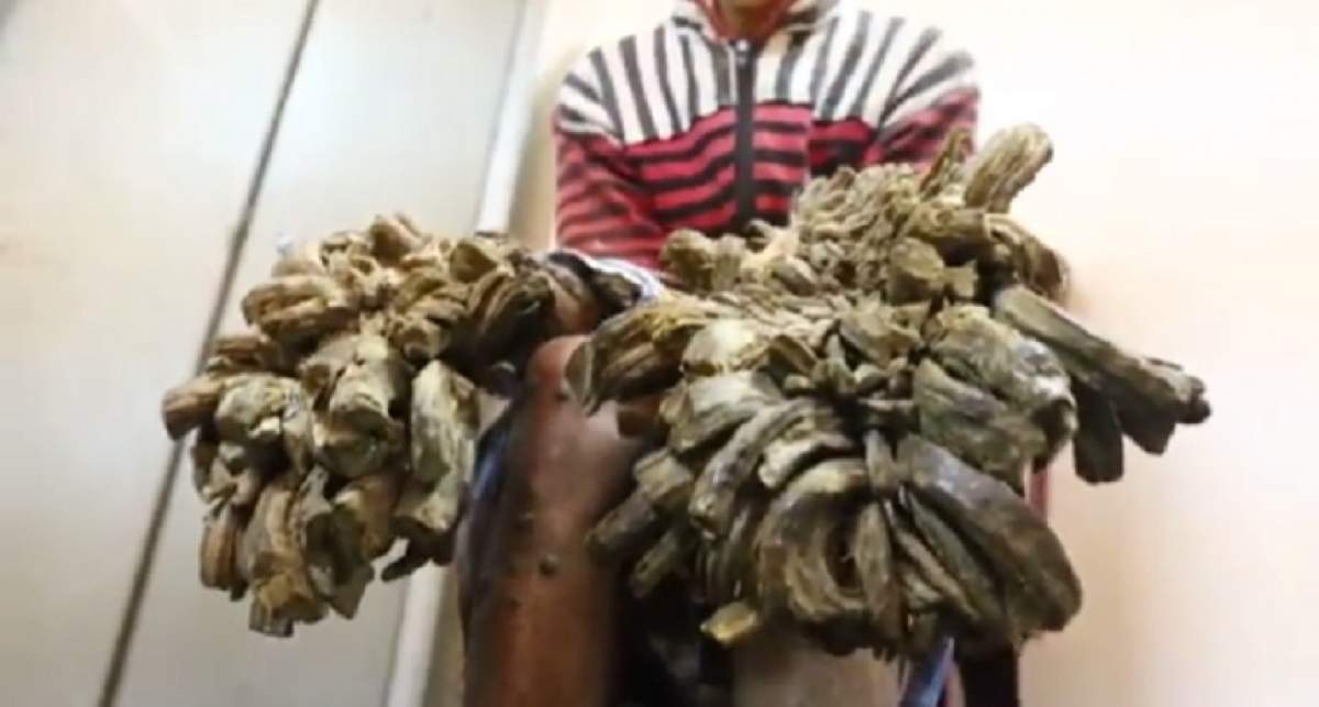 VIDEO / Șocant! Are crengi în loc de mâini. Un bărbat suferă de "boala omului-copac"