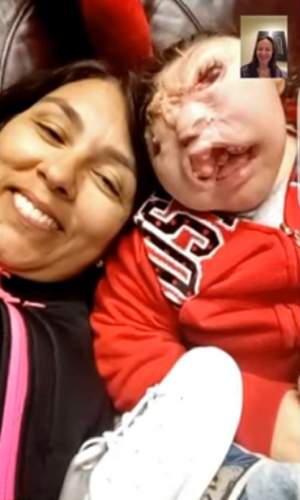 VIDEO / La ecograf nu s-a văzut nimic, dar a născut un copil fără faţă! E o minune ce s-a întâmplat, după ce medicii au refuzat să hrănească bebeluşul