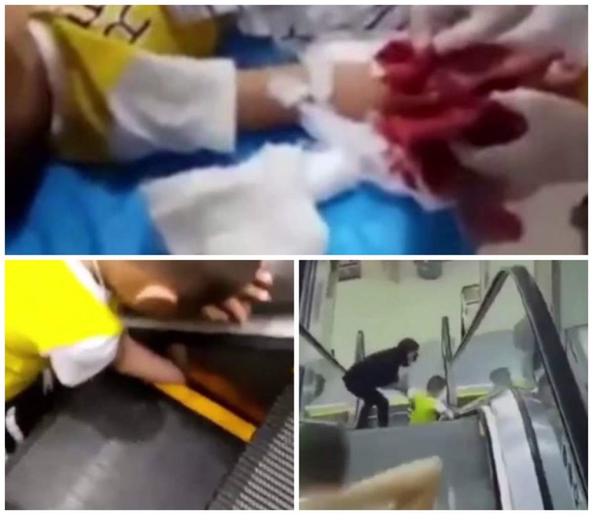 VIDEO / Șocant! Un copil era să rămână fără mână după ce a băgat-o în scara rulantă. Imaginile sunt greu de privit