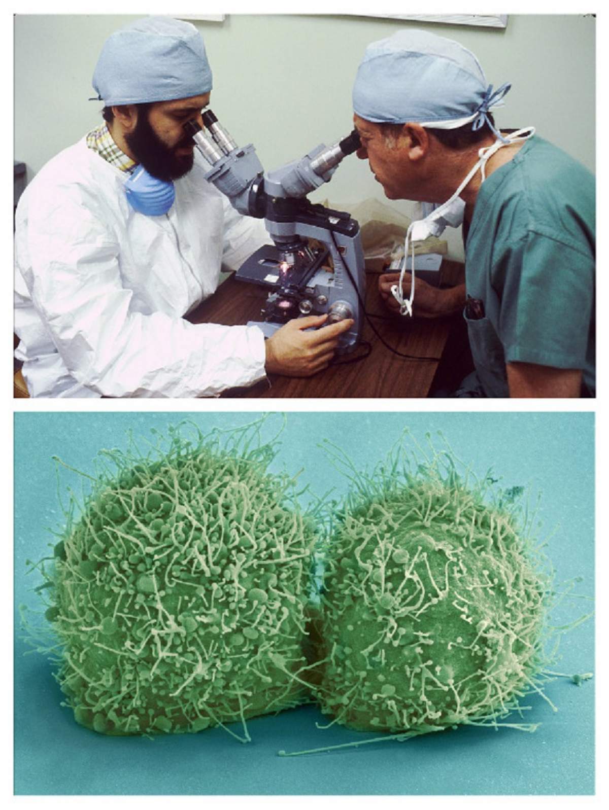 Atenţie! Asta este bacteria care te poate ucide în spital. Fereşte-te cât poţi de mult