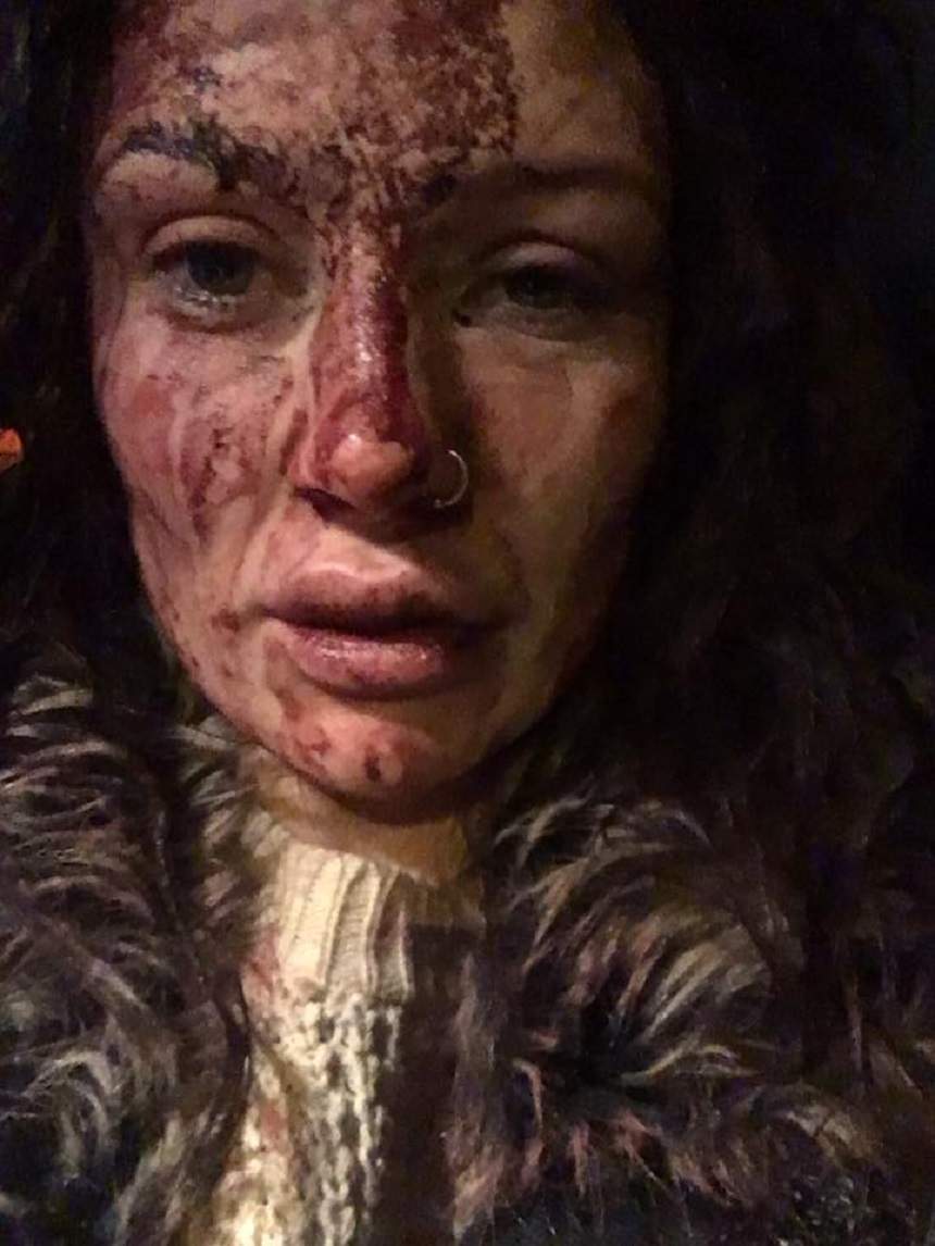 FOTO / Şocant! A fost bătută şi i s-a interzis să se machieze: "Nu există cuvinte să explic cât de groaznic este"