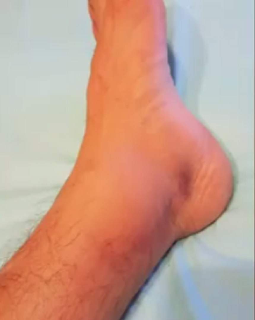 VIDEO / Marian Drăgulescu a ajuns de urgenţă la spital înainte de Campionatele Mondiale! Ce a păţit gimnastul: "Sper să mă refac"