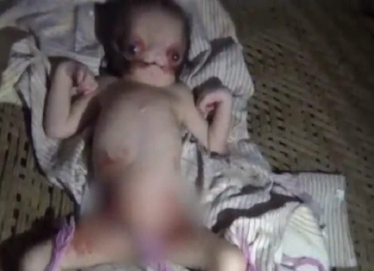 VIDEO / Bebeluşul care arată ca un extraterestru a generat isterie într-un sat! "Ochii lui erau roşii şi s-a născut fără urechi"
