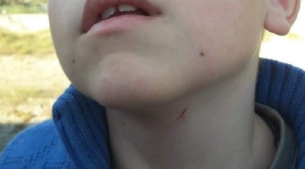 FOTO / Revoltător! Un învăţător din Botoşani a strâns de gât un copil până a rămas fără aer