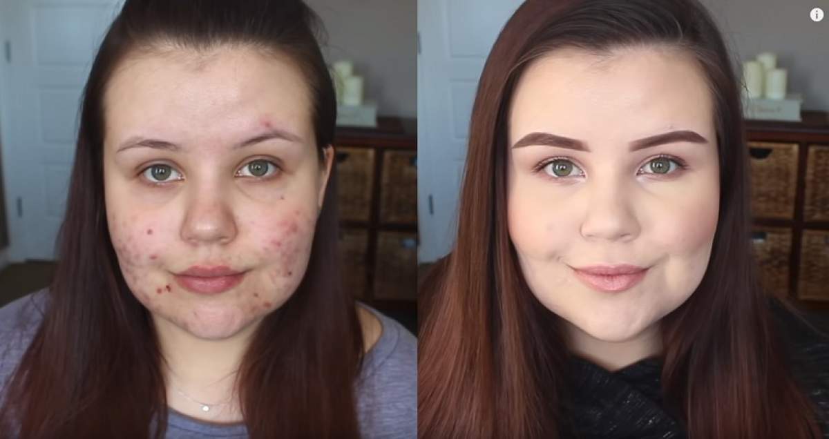 Cum poți avea un make-up „curat”, chiar dacă ai tenul acneic. Ce tip de fond de ten trebuie să folosești, pentru a arăta impecabil