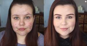 Cum poți avea un make-up „curat”, chiar dacă ai tenul acneic. Ce tip de fond de ten trebuie să folosești, pentru a arăta impecabil