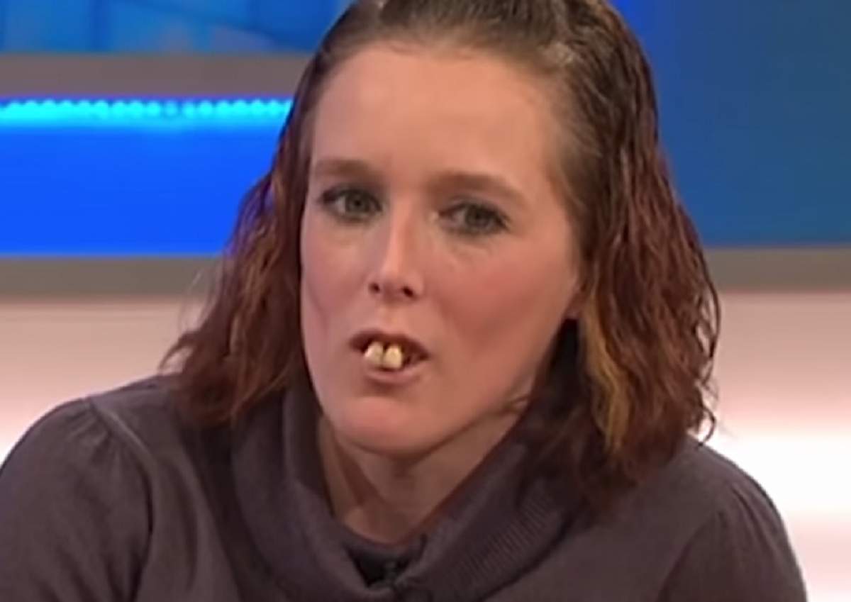 FOTO / Fata cu "cei mai urâți dinți din lume" s-a transformat radical! Uluitor cum arată în prezent