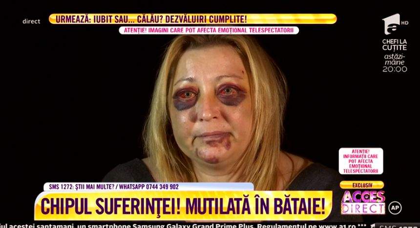 VIDEO / Violată şi desfigurată de fostul iubit. Drama femeii căreia îi este frică să mai iasă din casă. "Încearcă să mă omoare"