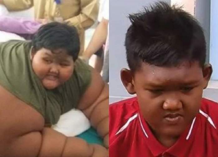 Foto Il Mai Stii Pe Cel Mai Gras Copil Din Lume Cum AratÄƒ Acum DupÄƒ Ce