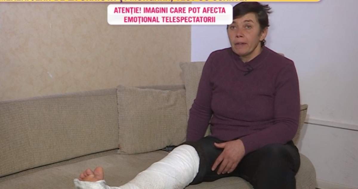 În lacrimi, o femeie din Vaslui acuză că soțul i-a rupt piciorul cu bătaia: „M-a împins de pe prispă”