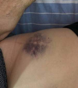 FOTO / Un manelist cunoscut, bătut crunt într-un club din Buzău! "Totul a fost o răzbunare"