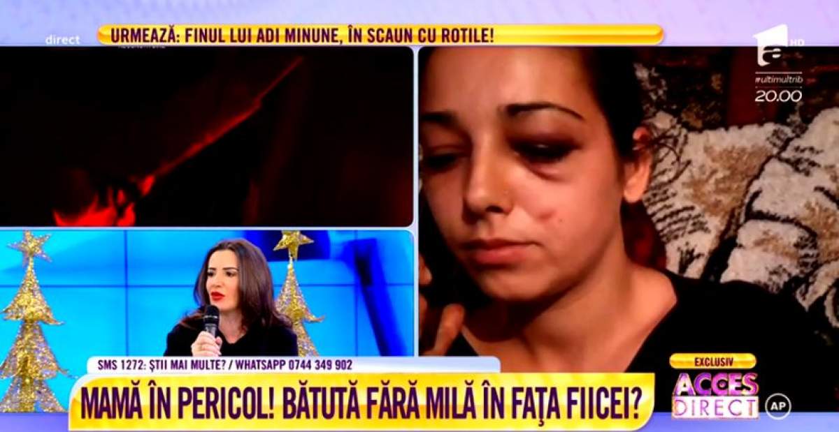 VIDEO / Snopită în bătaie de iubit. Tânăra mămică a rămas desfigurată!