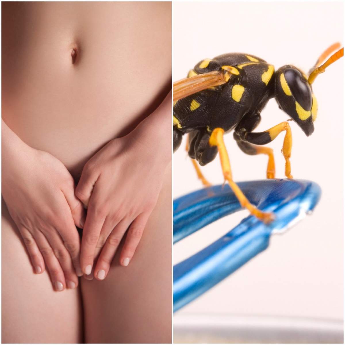 Frumusețe fără limite! Există tratamentul cu cuibi de viespi pentru zonele intime... și este foarte periculos