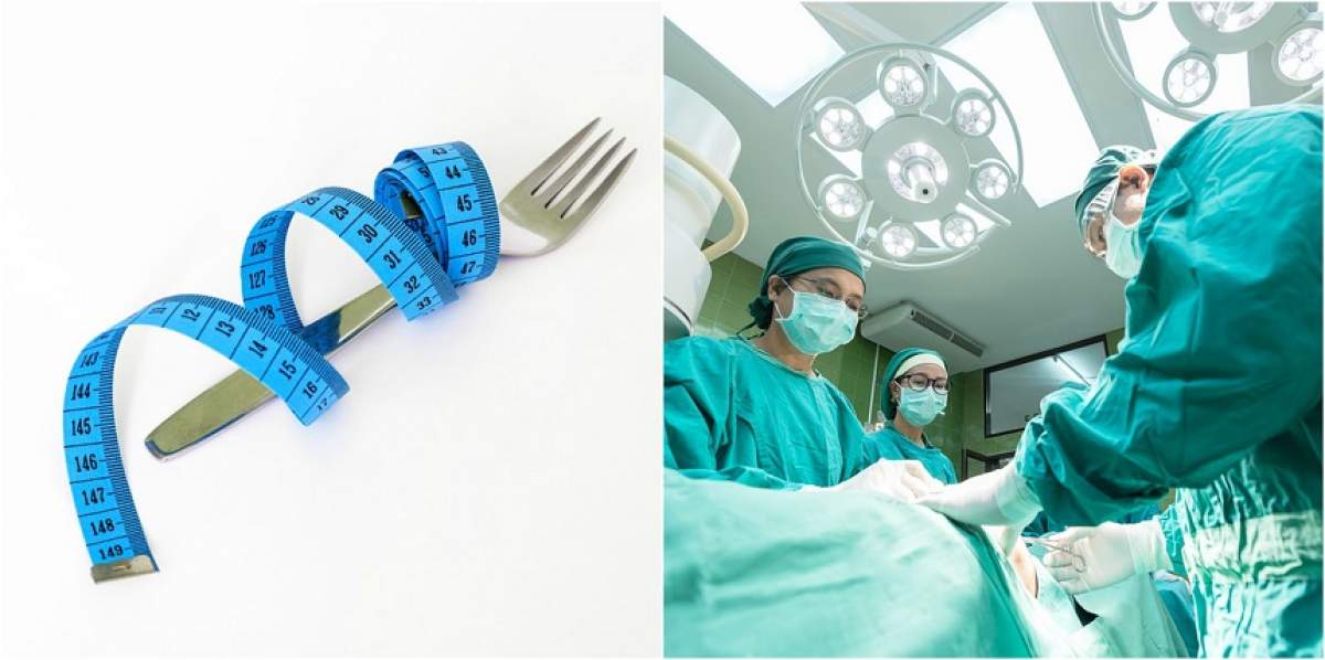 VIDEO / Vrei să slăbeşti, dar nu ştii cum? Beneficiile şi riscurile operaţiei de micşorare a stomacului