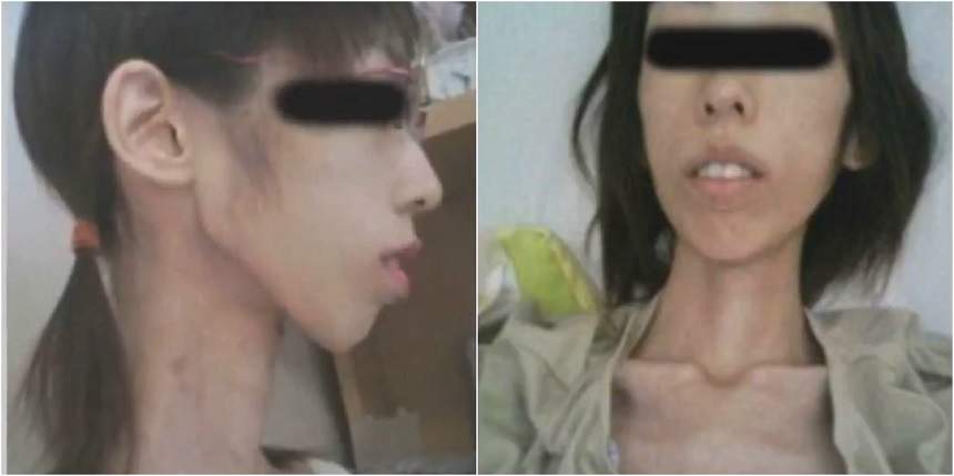 FOTO & VIDEO ŞOCANT / Abuzată şi înfometată de bunic! O fată şi-a văzut moartea cu ochii, după ce a ajuns să aibă 16 kilograme