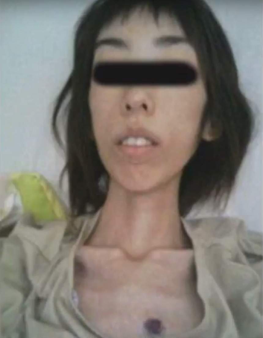 FOTO & VIDEO ŞOCANT / Abuzată şi înfometată de bunic! O fată şi-a văzut moartea cu ochii, după ce a ajuns să aibă 16 kilograme