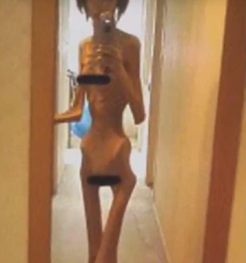 FOTO & VIDEO ŞOCANT / Abuzată şi înfometată de bunic! O fată şi-a văzut moartea cu ochii, după ce a ajuns să aibă 16 kilograme