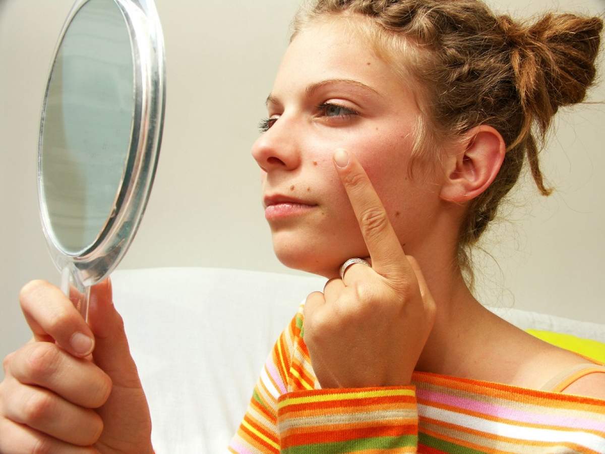5 moduri naturale de a elimina impurităţile de pe faţă. Ce spui de numărul 2?
