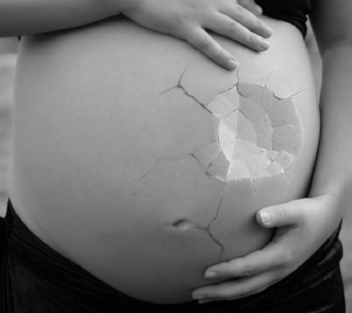 Semnele producerii unui avort spontan. Multe femei însărcinate ignoră simptomele banale