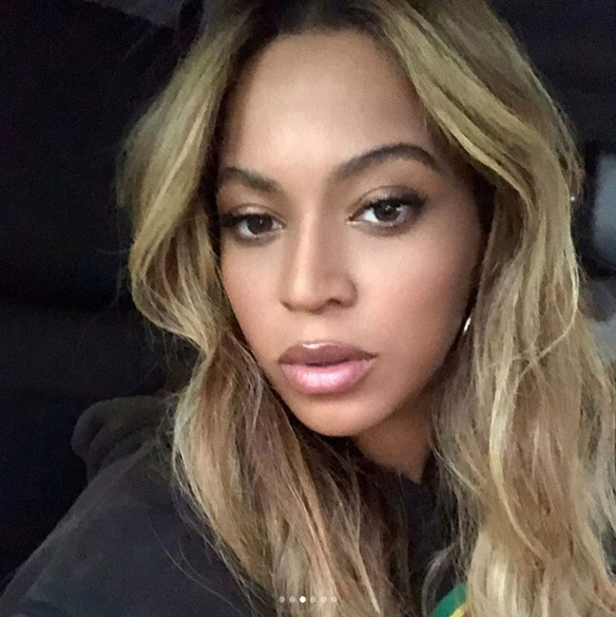 Cine a mușcat-o pe Beyonce de față? Artista a trecut prin momente neplăcute