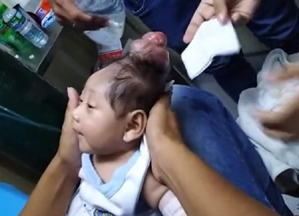 FOTO / Halucinant! Un bebeluș s-a născut cu un "corn" pe mijlocul capului