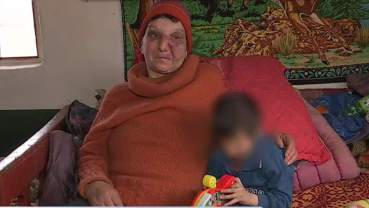 VIDEO / Sora zdrobită şi abuzată de fratele ei? "Nu am bătut-o, a căzut pe un gard!"