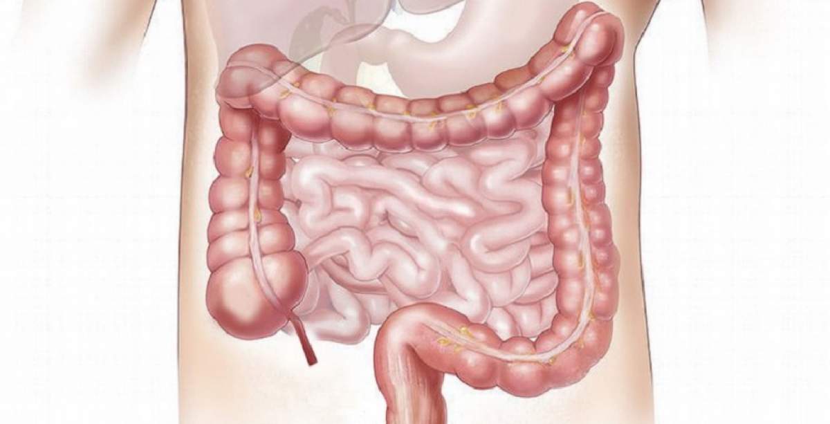 Cancerul intestinului gros: prezintă-te la medic dacă ai aceste simptome!