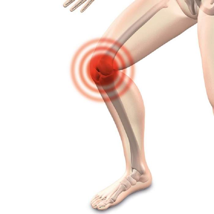 Ce afecţiuni grave ascund durerile de genunchi. Nu le mai neglija