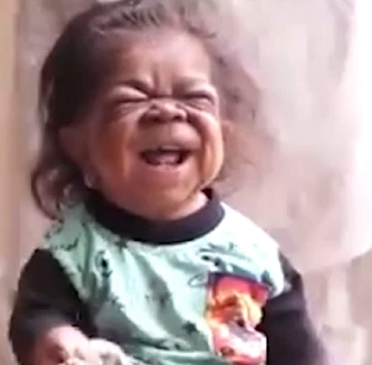 VIDEO / Are 23 de ani, dar arată ca un bebeluș! Imagini cutremurătoare cu bărbatul prins într-un corp de copil