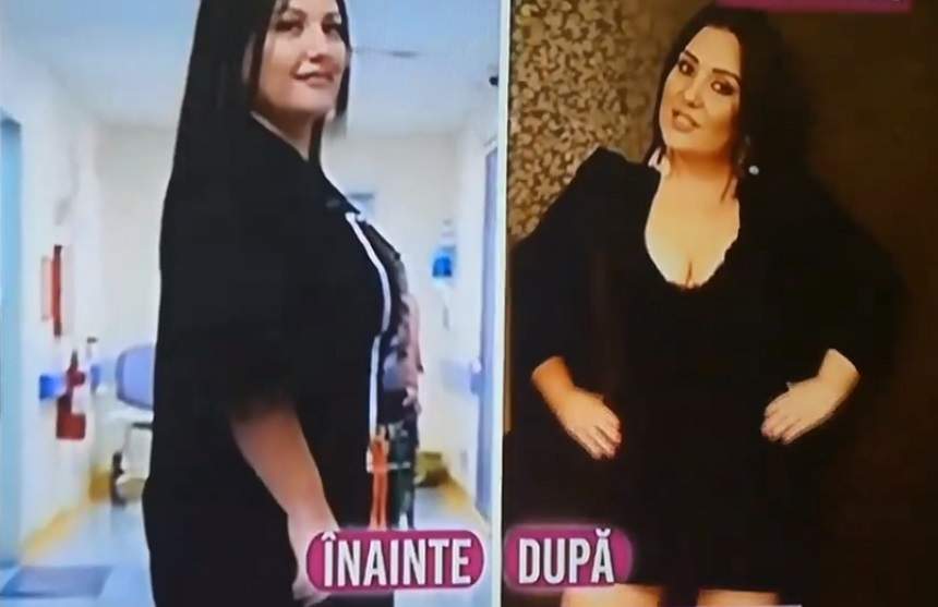 FOTO / Bianca Rus a slăbit spectaculos după operația de micșorare a stomacului! Câte kilograme a dat jos în nici 3 luni