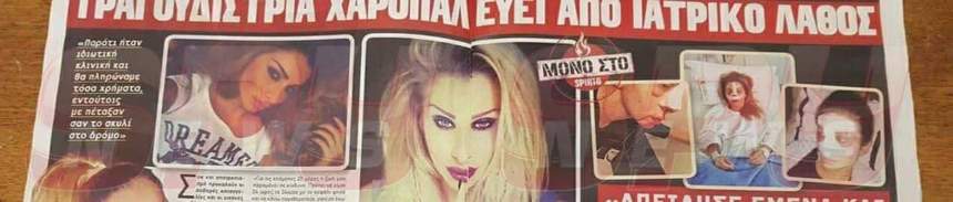 Incredibil! O artistă de la noi a intrat în comă în timpul operației de rinoplastie! A ajuns mutilată. Declarații exclusive