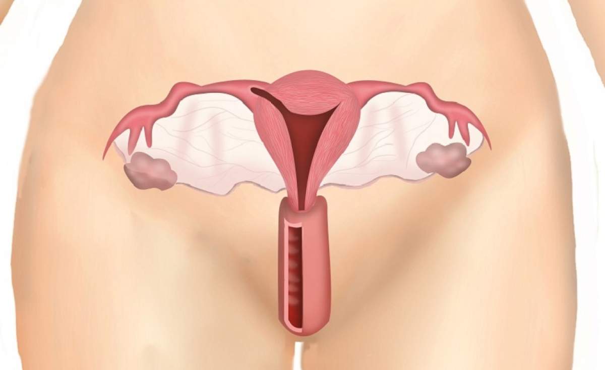 ÎNTREBAREA ZILEI: Tu știi ce boli se ascund în spatele durerilor de ovare? Simptomele pe care te trimit de urgență la medic