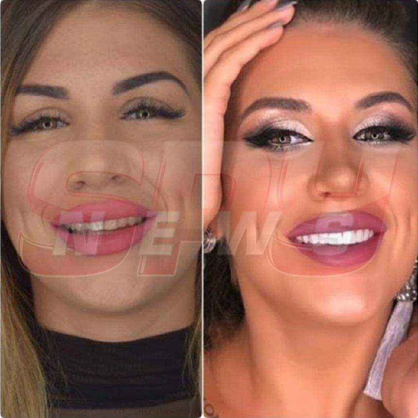 FOTO / Schimbare după schimbare! Alexandra de la "Insula Iubirii" şi-a pus faţete dentare