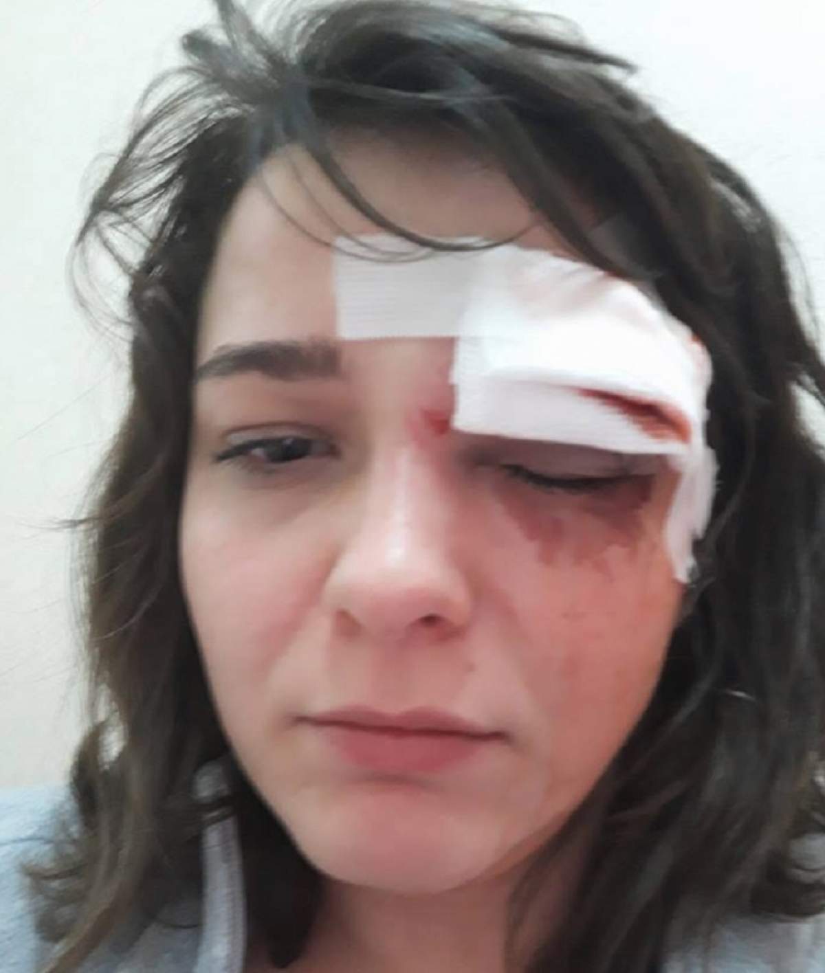 FOTO / Imagine şocantă! O tânără a fost bătută şi tâlhărită pe o stradă din Bucureşti