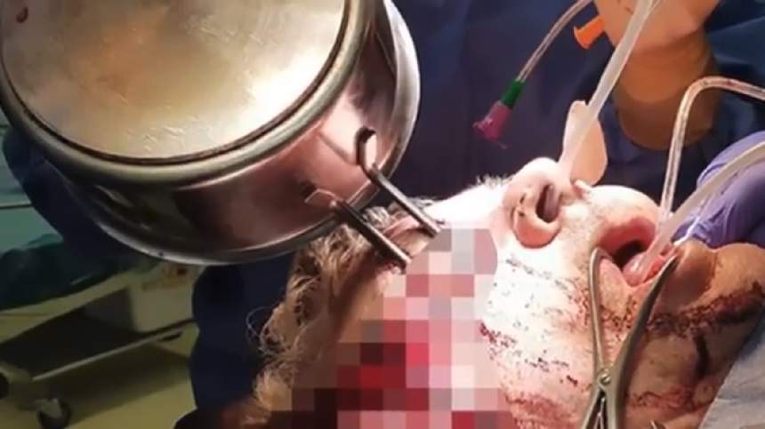 FOTO & VIDEO / Un bărbat a ajuns la spital cu mânerul unei tigăi în ochi, după o noapte de beție