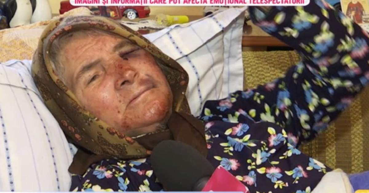 VIDEO / Bătută cu bestialitate la 71 de ani! Bătrânica a fost desfigurată şi jefuită de doi mascați