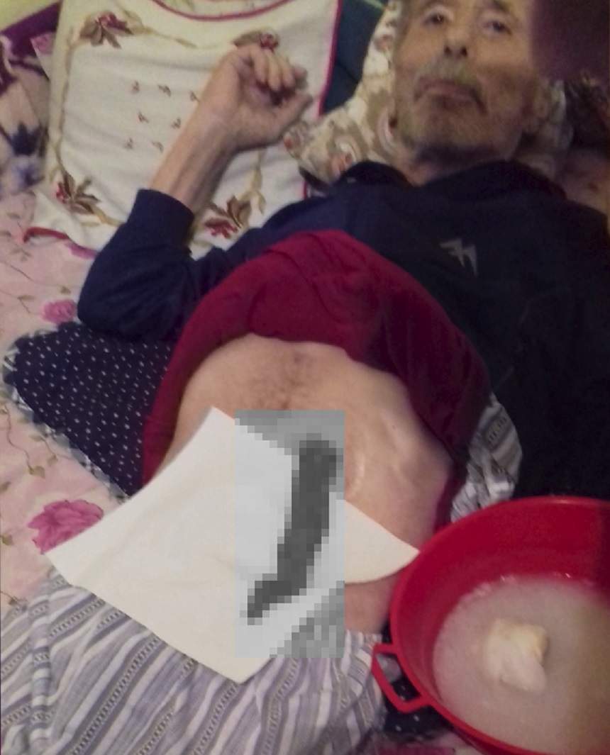 FOTO / Un medic din Buzău, acuzat că i-a lăsat unui pacient în abdomen o faşă de un metru
