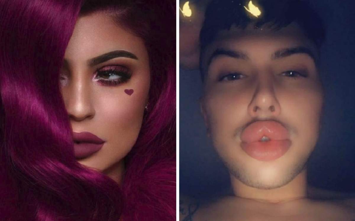 FOTO / A vrut să arate precum Kylie Jenner, dar a exagerat cumplit şi buzele lui sunt la un pas să explodeze: "Nu o să mă opresc niciodată"