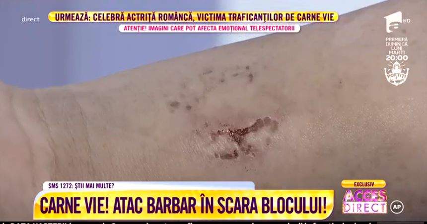 VIDEO / Act de canibalism în scara blocului! Croitoreasa Alinei Petre, muşcată până la sânge de un dependent de droguri