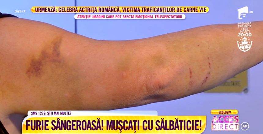 VIDEO / Act de canibalism în scara blocului! Croitoreasa Alinei Petre, muşcată până la sânge de un dependent de droguri