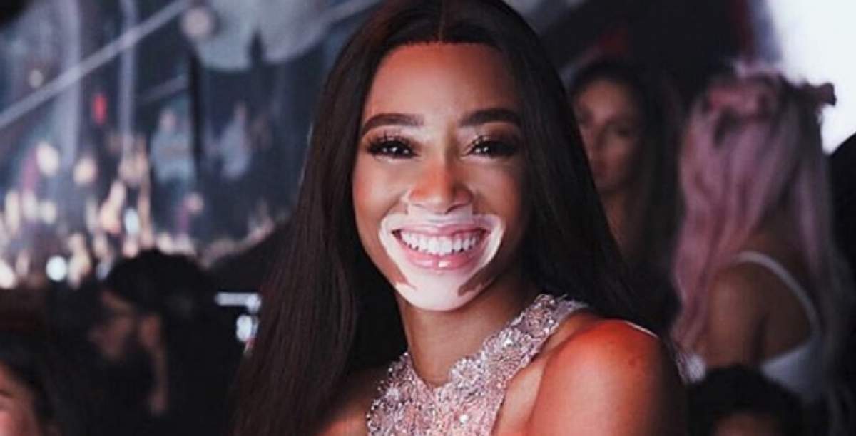 FOTO / Modelul internațional Winnie Harlow, pictorial incendiar pe un yaht de lux. Boala pe care o are nu o împiedică să fie super hot