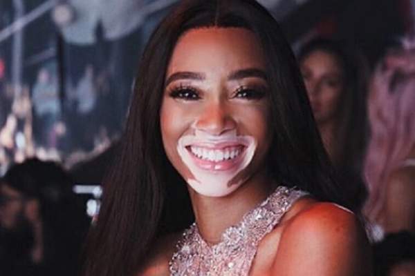 FOTO / Modelul internațional Winnie Harlow, pictorial incendiar pe un yaht de lux. Boala pe care o are nu o împiedică să fie super hot