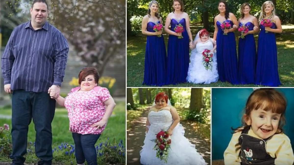 FOTO / A murit la doar patru ani de la nuntă! Femeia cu oasele fragile a fost doborâtă de boala care a chinuit-o o viață întreagă