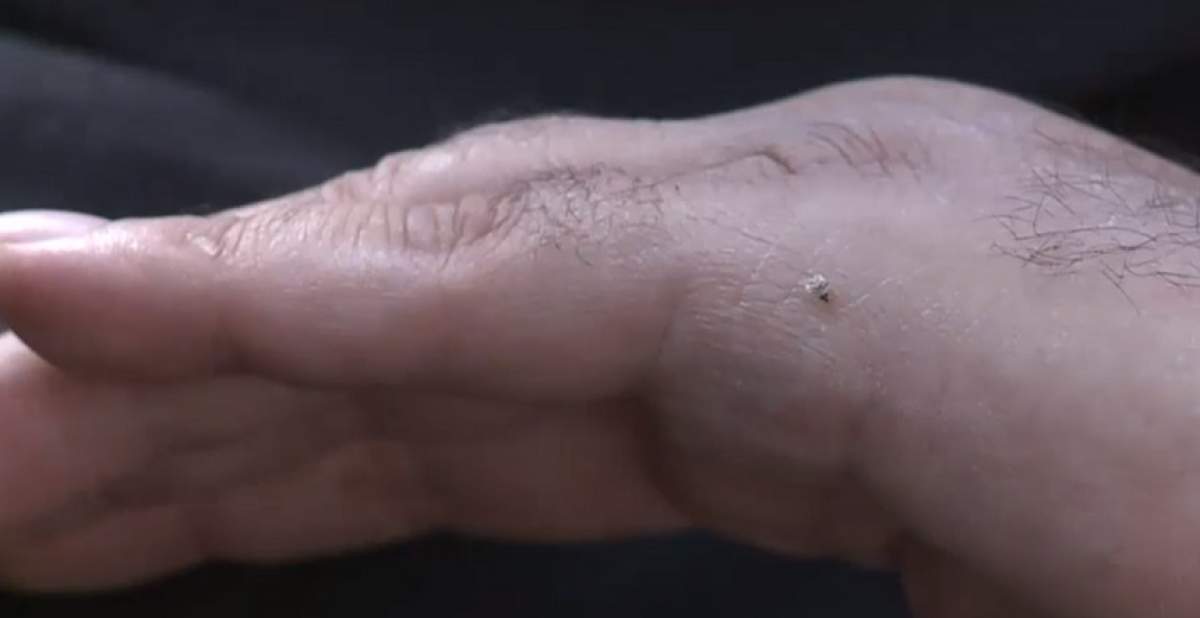 VIDEO / O insectă minisculă, inamicul public numărul unu al bucureștenilor. Ce este tigrul platanului și ce spun medicii despre înțepătură